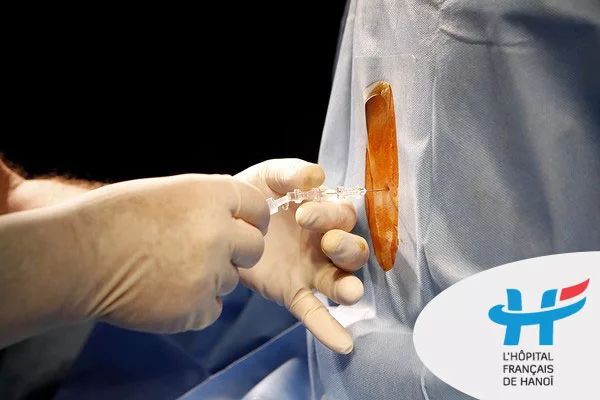 What Pregnant Women Should Know About Epidural Analgesia For Labor