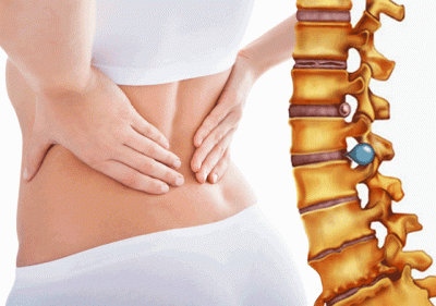 Herniated disc