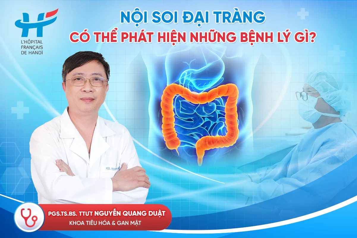 Nội soi đại tràng có thể phát hiện những bệnh lý gì?