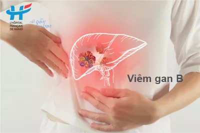 Viêm gan B