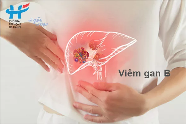 Viêm gan B