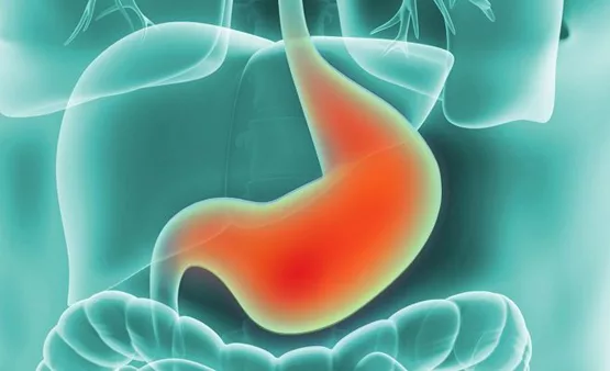 Close-up on H. pylori: preventing gastric cancer