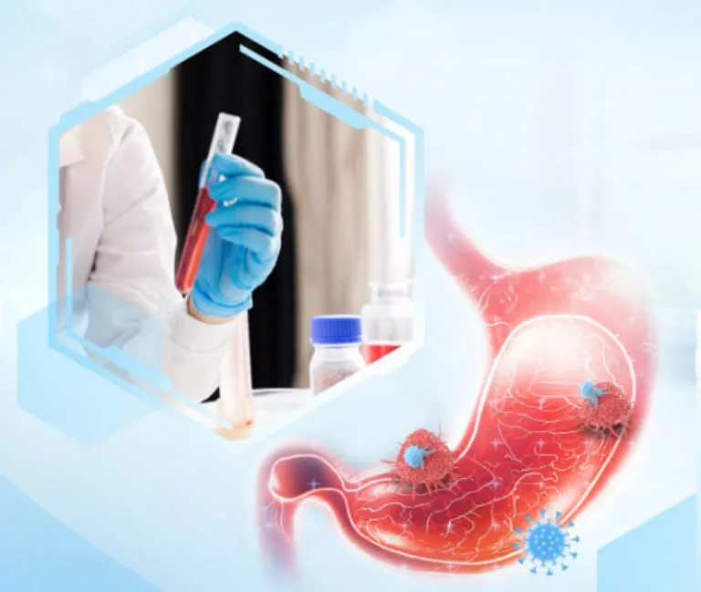 Top 10 các bệnh về đường tiêu hóa thường gặp hiện nay