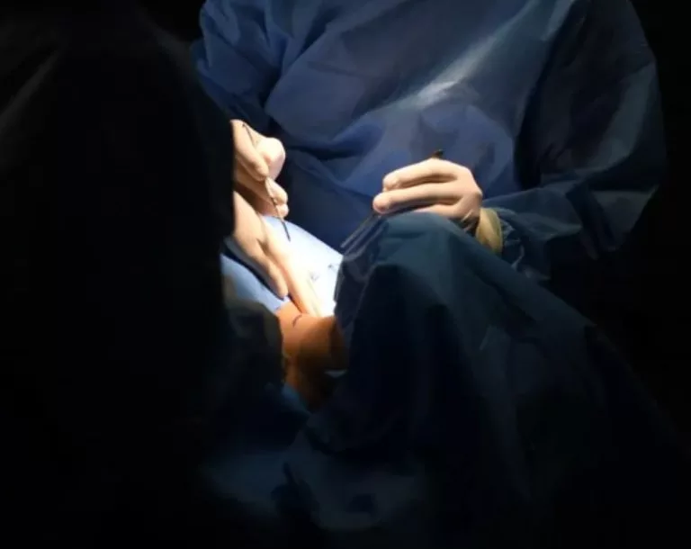 Indications and current techniques of endoscopic cervical discectomy