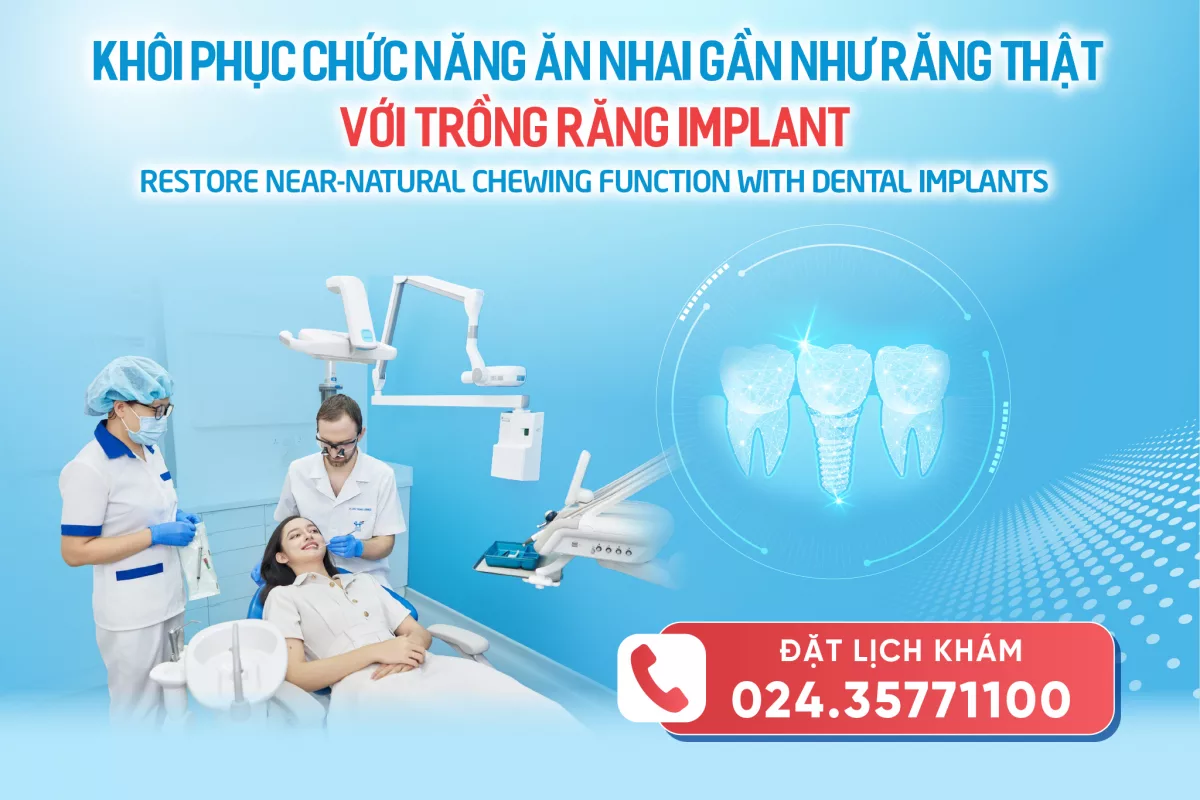 KHÔI PHỤC CHỨC NĂNG ĂN NHAI GẦN NHƯ RĂNG THẬT VỚI TRỒNG RĂNG IMPLANT