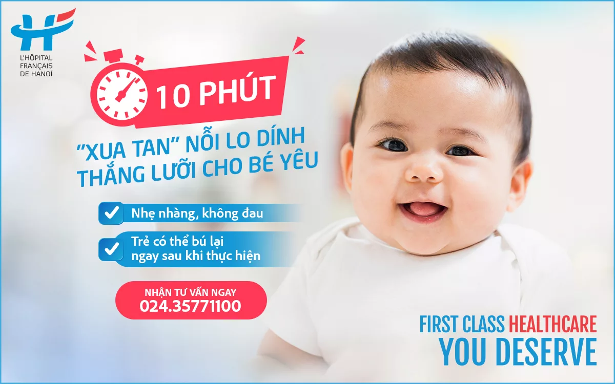 Đặt lịch cắt thắng lưỡi cho trẻ tại Bệnh viện Việt Pháp Hà Nội