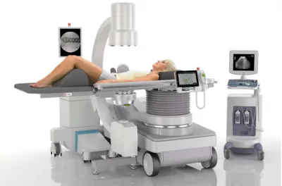 Điều trị sỏi tiết niệu bằng phương pháp tán sỏi ngoài cơ thể sử dụng máy Storz