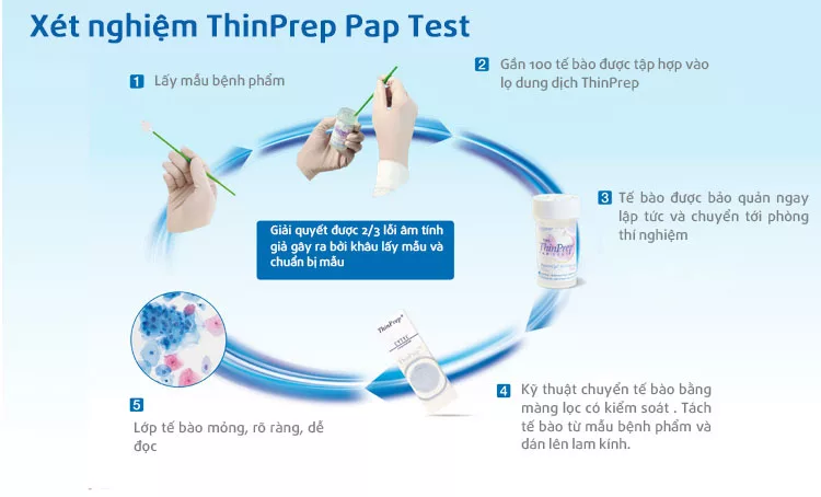 ThinPrep Test - Tiến bộ mới trong phát hiện sớm ung thư cổ tử cung