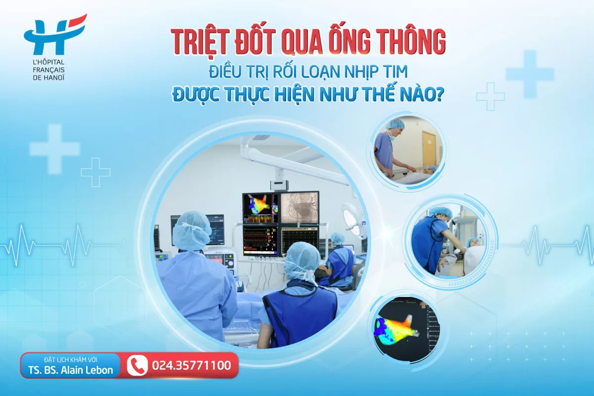 TRIỆT ĐỐT QUA ỐNG THÔNG ĐIỀU TRỊ RỐI LOẠN NHỊP TIM ĐƯỢC THỰC HIỆN NHƯ THẾ NÀO?