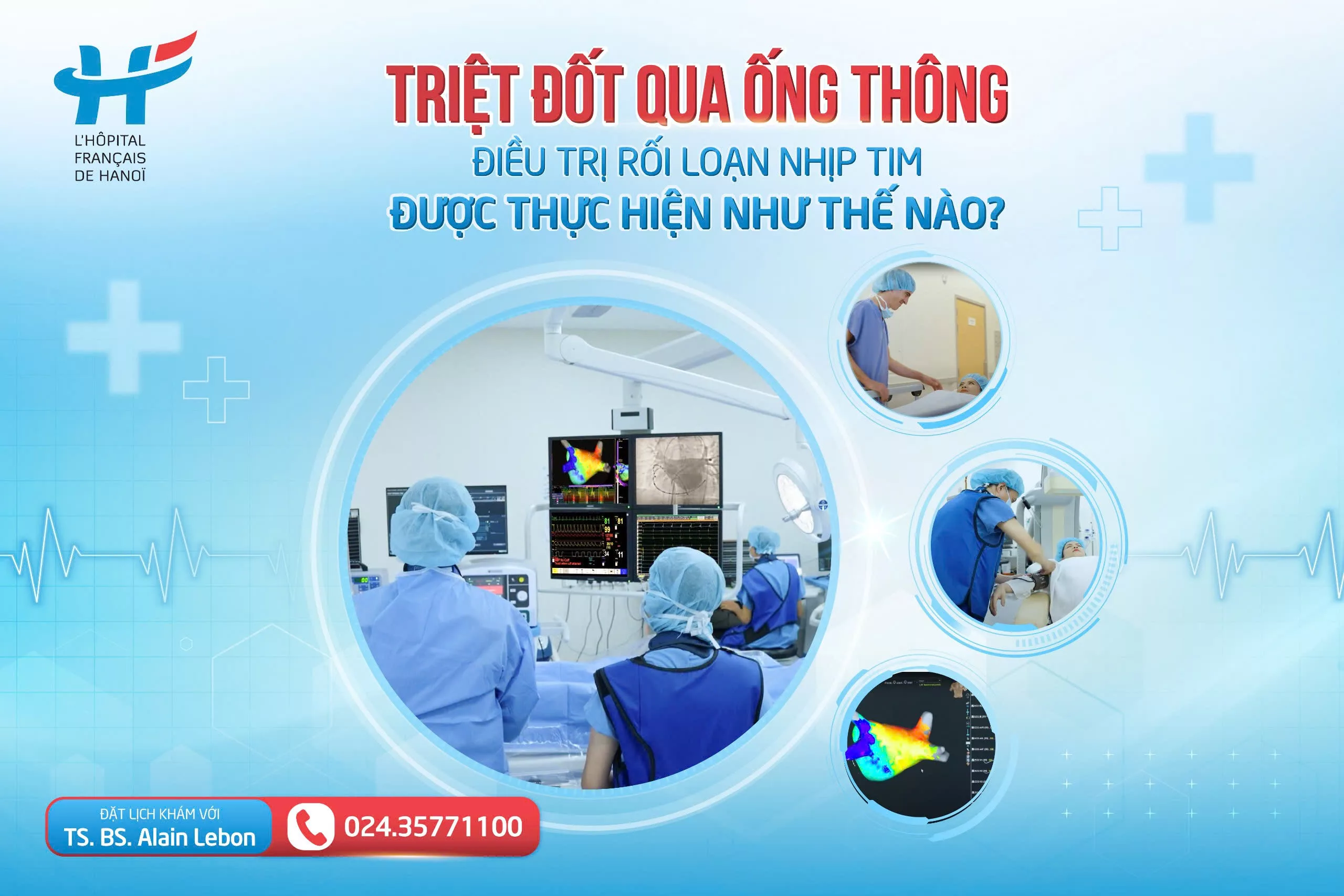 TRIỆT ĐỐT QUA ỐNG THÔNG ĐIỀU TRỊ RỐI LOẠN NHỊP TIM ĐƯỢC THỰC HIỆN NHƯ THẾ NÀO?