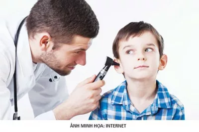 Viêm tai giữa thanh dịch