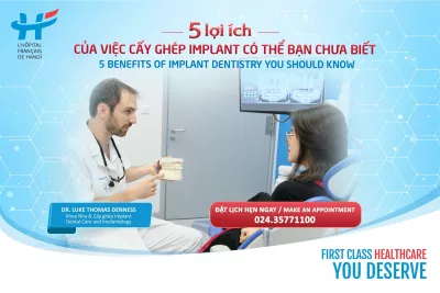 5 LỢI ÍCH CỦA VIỆC CẤY GHÉP IMPLANT CÓ THỂ BẠN CHƯA BIẾT